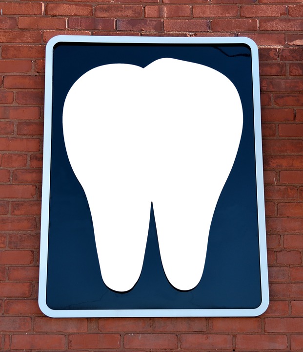 Les avantages des implants dentaires 
