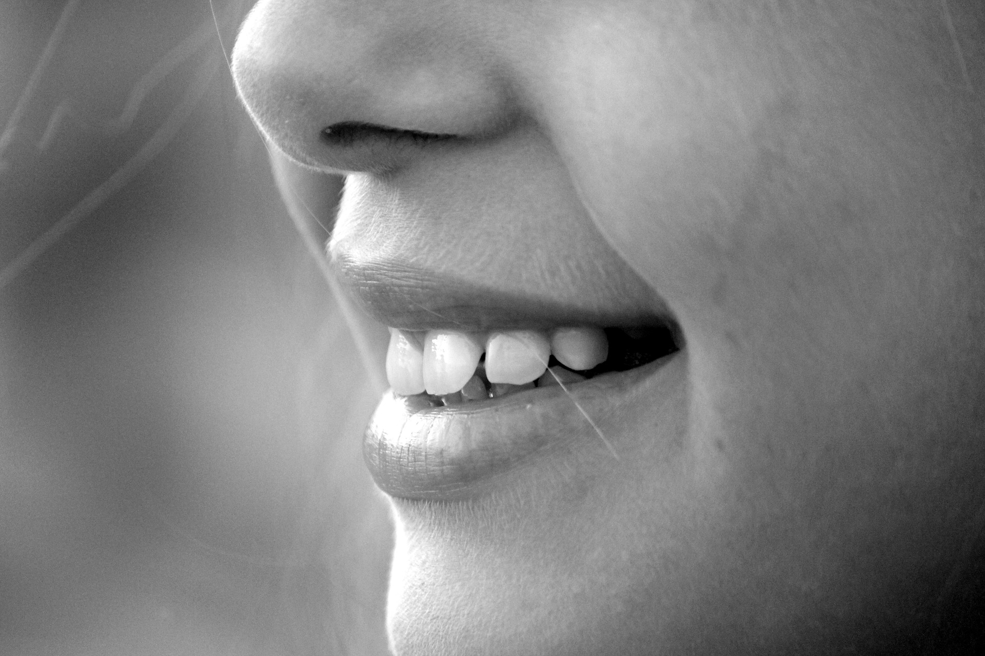 Les dents blanches, conseils d'un dentiste Montpellier